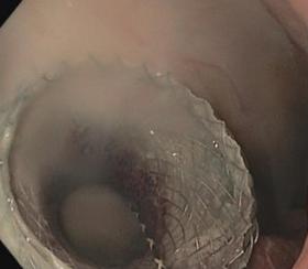 2018年4月20-21日（芝加哥）2018临床实践之内窥镜发展