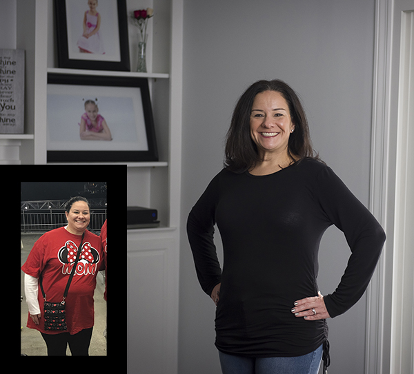 在新的门诊手术帮助下,忙碌的咨询师成功瘦身 在新的门诊手术帮助下,忙碌的咨询师成功瘦身