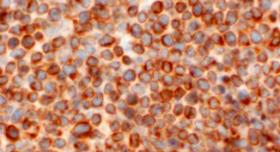 2019年4月12-13日（芝加哥）第16届年会：国际Ultmann芝加哥淋巴瘤研讨会