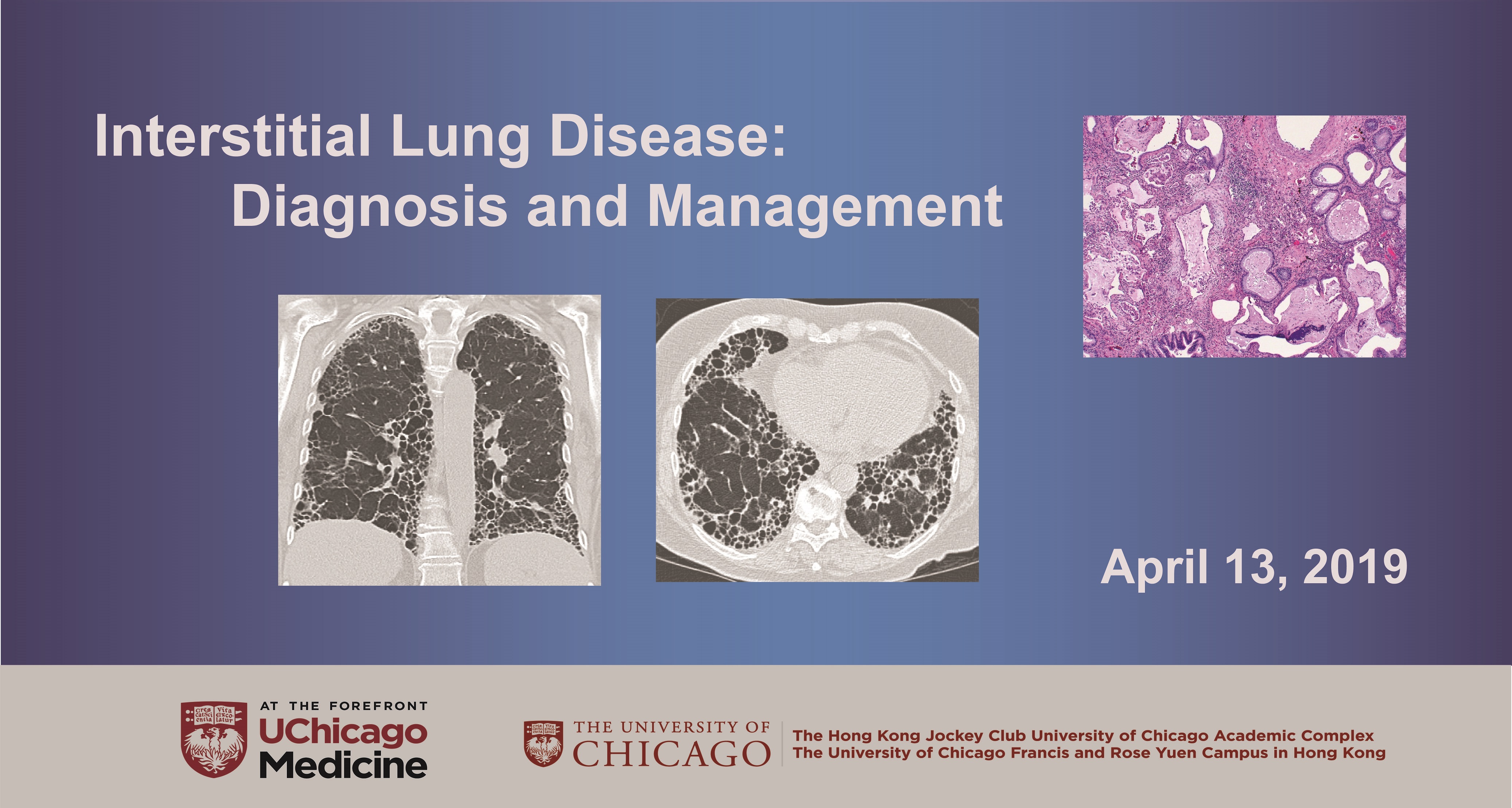 2019年4月13日（香港）间质性肺病的诊断与治疗