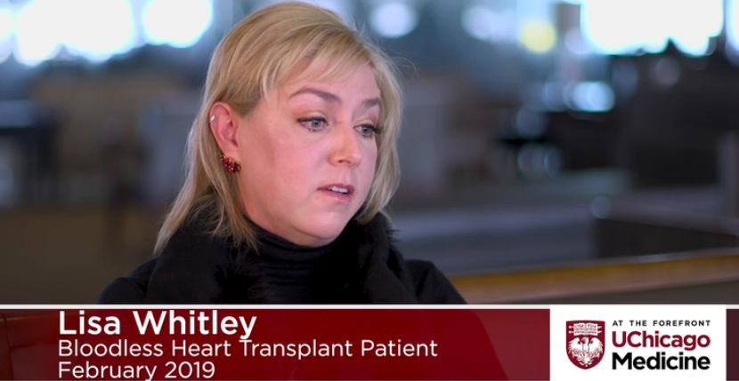 巨细胞性心肌炎女性患者接受无血心脏移植 巨细胞性心肌炎女性患者接受无血心脏移植