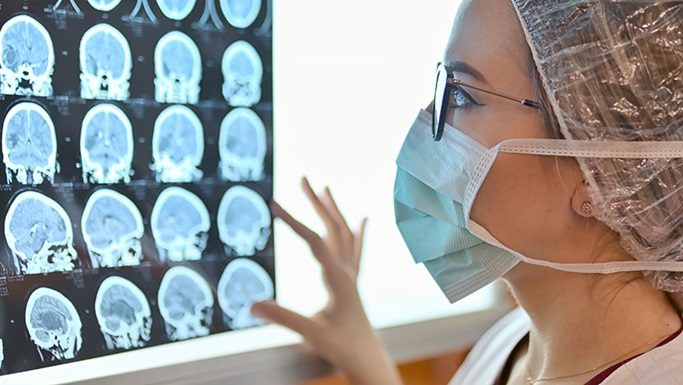 脑癌的注意事项及其他常见问题