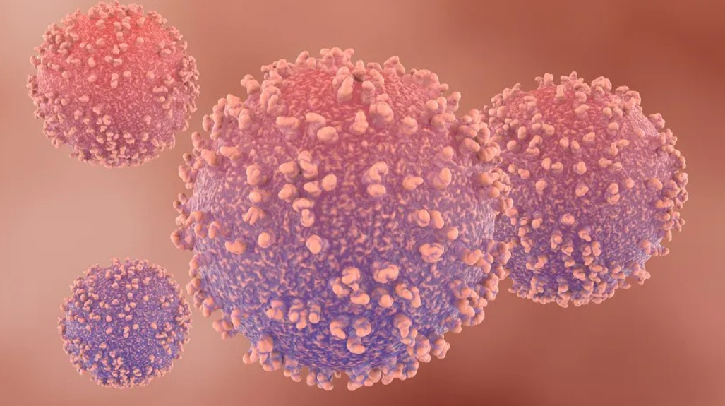 全美首批晚期黑色素瘤肿瘤浸润淋巴细胞疗法提供者